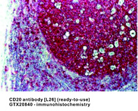 Anti-CD20 Mouse Monoclonal Antibody [clone: L26]