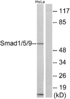 Anti-Smad1 + Smad5 + Smad9 Rabbit Polyclonal Antibody