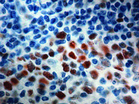 Anti-MSH6 Mouse Monoclonal Antibody [clone: 44]