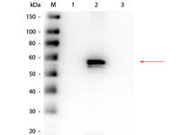 Anti-AKT2 Rat Monoclonal Antibody [Clone: 16G11.E8]