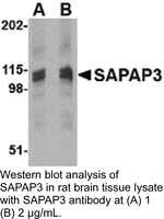 Anti-DLGAP3 Rabbit Polyclonal Antibody