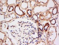 Anti-HSPB1 Rabbit Polyclonal Antibody