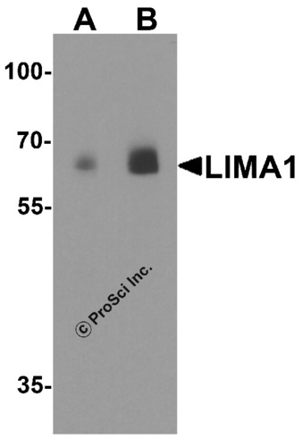 LIMA1 antibody