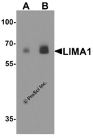 Anti-LIMA1 Rabbit Polyclonal Antibody