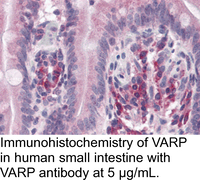 Anti-VARP Rabbit Polyclonal Antibody