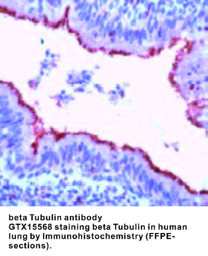 Rabbit Polyclonal antibody to beta Tubulin (tubulin, beta)