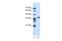 Anti-PCBP1 Rabbit Polyclonal Antibody