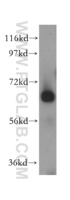 Anti-BSDL Rabbit Polyclonal Antibody