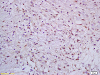 Anti-MED26 Rabbit Polyclonal Antibody