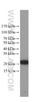 Anti-Cofilin Mouse Monoclonal Antibody [clone: 1G6A2]