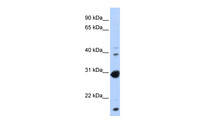 Anti-NR0B2 Rabbit Polyclonal Antibody