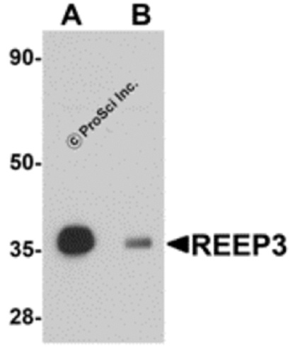 REEP3 antibody