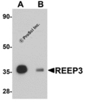 Anti-REEP3 Rabbit Polyclonal Antibody