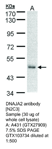 Rabbit Polyclonal antibody to DNAJA2 (DnaJ (Hsp40) homolog, subfamily A, member 2)