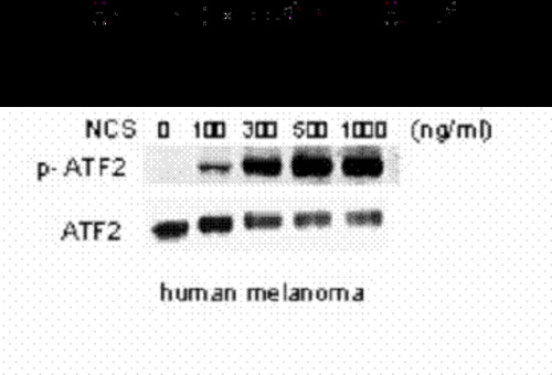 ATF2 (phospho Ser 490/498) Antibody