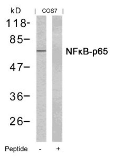 NFkB p65 (Ab 435) Antibody