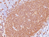 Anti-CD20 Mouse Monoclonal Antibody [clone: L26 + IGEL/773]