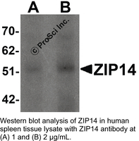 Anti-ZIP14 Rabbit Polyclonal Antibody