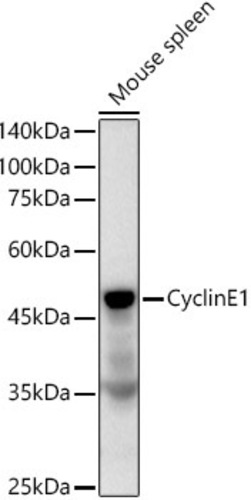 Anti-Cyclin E1 Rabbit Monoclonal Antibody [clone: ARC51383]