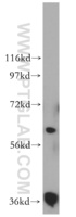 Anti-RDH14 Rabbit Polyclonal Antibody