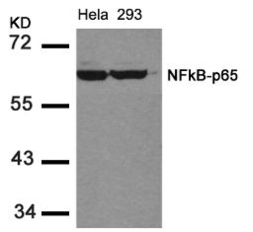 NFkB p65 (Ab 536) Antibody