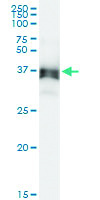 Anti-ACAD8 Polyclonal Antibody Pair