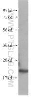 Anti-CDC42 Rabbit Polyclonal Antibody
