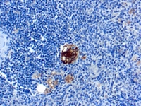 Anti-Tartrate Resistant Acid Phosphatase Mouse Monoclonal Antibody [clone: SPM601]