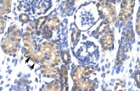 Anti-PSMC3 Rabbit Polyclonal Antibody