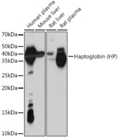 Anti-Haptoglobin Rabbit Monoclonal Antibody [clone: ARC1298]