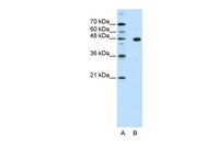 Anti-PRDM12 Rabbit Polyclonal Antibody