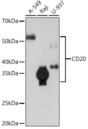 Anti-CD20 Rabbit Monoclonal Antibody [clone: ARC51683]