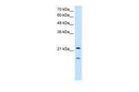 Anti-MMP7 Rabbit Polyclonal Antibody