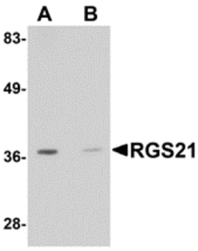 RGS21 antibody