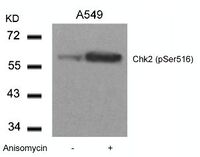 Anti-CHEK2 Rabbit Polyclonal Antibody