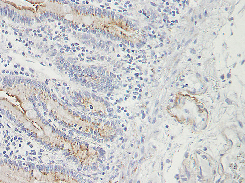 TECK Monoclonal antibody 0.5 mg