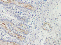 Anti-CCL25 Mouse Monoclonal Antibody [clone: 1.2_4G1-1G4-1C9]