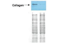 Anti-COL1A1 Rabbit Polyclonal Antibody (FITC)