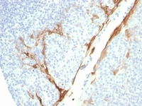 Anti-Cytokeratin 16 Mouse Recombinant Antibody [clone: rKRT16/1714]