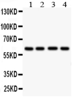 Anti-HEXA Rabbit Polyclonal Antibody