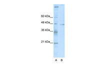 Anti-TSG101 Rabbit Polyclonal Antibody