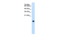 Anti-CST4 Rabbit Polyclonal Antibody