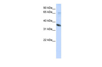 Anti-ST6GALNAC1 Rabbit Polyclonal Antibody