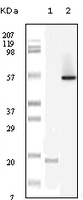 Anti-LYN Mouse Monoclonal Antibody [clone: 2H8D7]