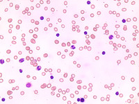 White Blood Cell, Human Slide