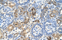 Anti-HNRNPL Rabbit Polyclonal Antibody
