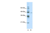 Anti-DDX25 Rabbit Polyclonal Antibody