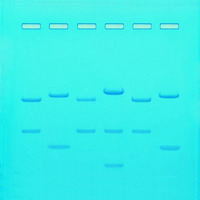 DNA Fingerprinting by Restriction Enzyme Patterns