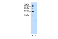 Anti-PPFIBP1 Rabbit Polyclonal Antibody