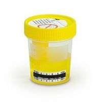TransferTop™ Urine Collection and Transfer Container, Globe Scientific